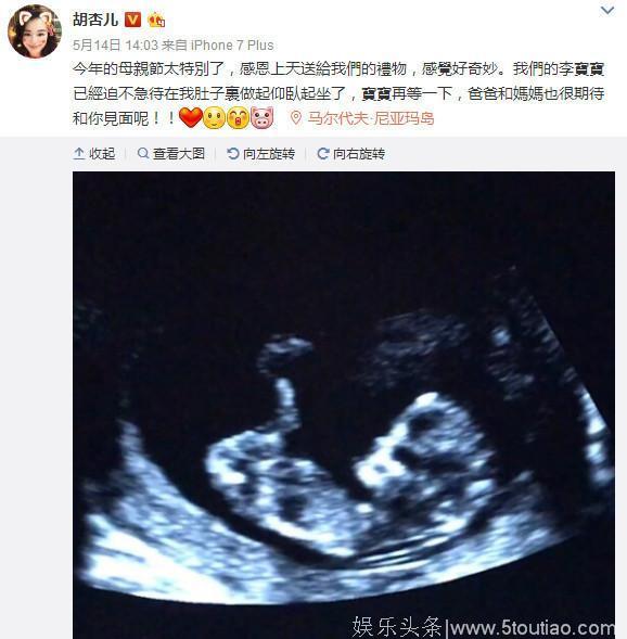 孕妈胡杏儿超能吃却也很困惑：鼻子变得越来越肥大