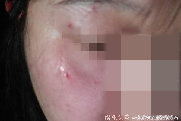 徐峥殴打女记者轰动娱乐圈 目击者透漏行为暴力连踹记者面部三脚