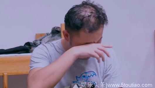 沙溢无意间暴露了秃头，杨幂发际线堪忧，郑少秋戴了30多年假发