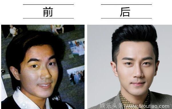 盘点那些整容后变好看的男明星 你知道都有谁吗？