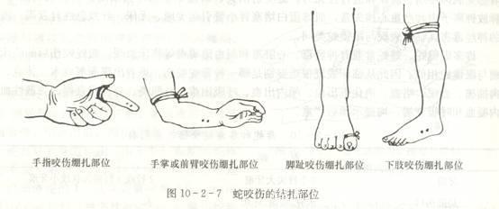 影视剧中的医学误区，现实与艺术终究是有差距的