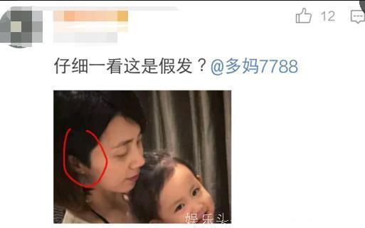 胡杏儿生完孩子发际线退到后脑勺了，孙莉生完三胎直接戴假发遮丑