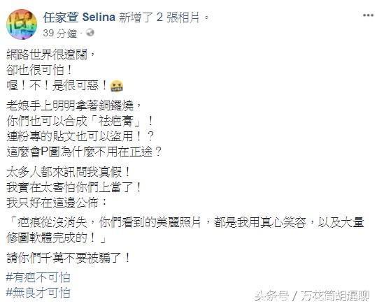 7年前火吻疤消失了？Selina怒曝「真实原图」打脸痛骂！