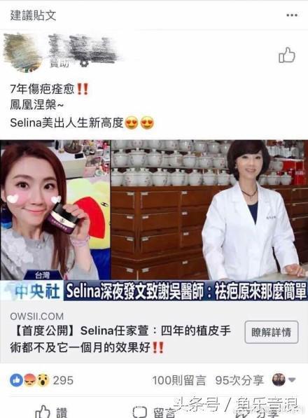 Selina自曝美照靠修图 自揭伤疤只为打脸无良商家