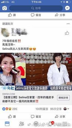 Selina任家萱怒斥无良商家 疤痕没消失 曾经是多少人的女神