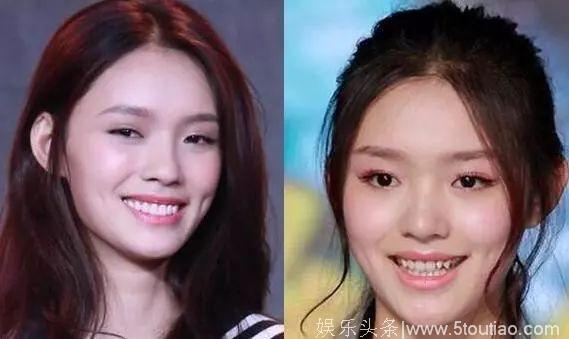 吴昕曝明星最爱整部位，AngelaBaby、杨幂都整过，网友：看出来了