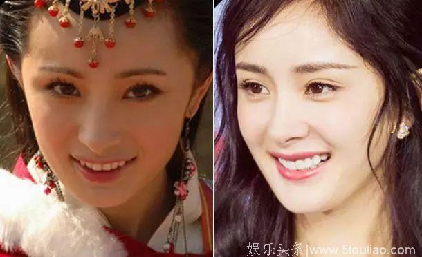 吴昕曝明星最爱整部位，AngelaBaby、杨幂都整过，网友：看出来了