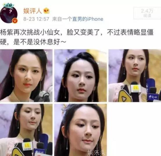 周迅灵气不再，杨紫被嘲变脸，被水肿拖垮颜值的明星不止有她们