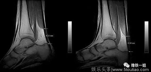 女明星为了显高简直丧心病狂！