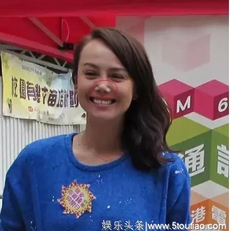 前TVB花旦被传整容失败消失娱乐圈 如今亲自接受访问解释