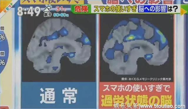 日本节目新研究：一天玩手机超过1小时会痴呆