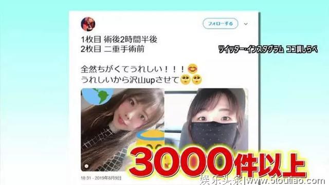 承认整容再也不丢脸？日本女生提出5大公开理由