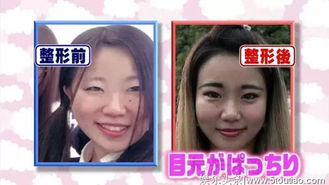 承认整容再也不丢脸？日本女生提出5大公开理由