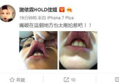 谢依霖口腔溃疡拍照上传网友直呼太直爽